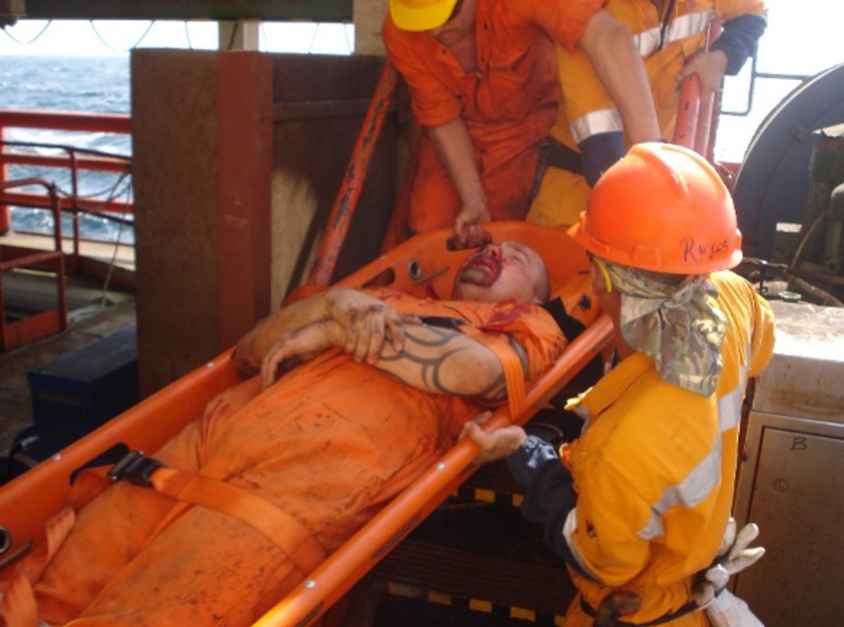 Air Compressor Injuries Diver injury during air cylinder recharging