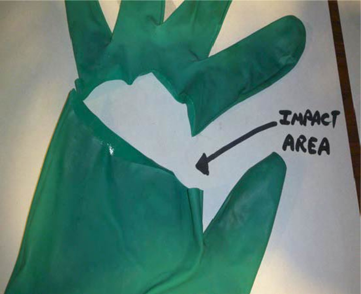 Glove worn by injured person