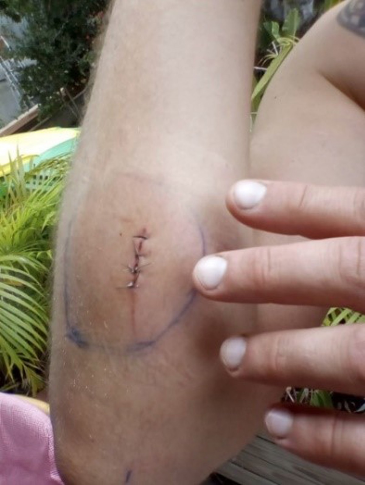 IMCA SF Sharp wire: injury during routine maintenance Cut to arm required stitches