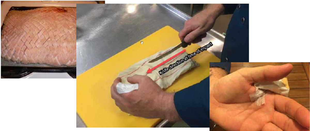 Experienced cook in the galley badly injured his hand when his knife  slipped