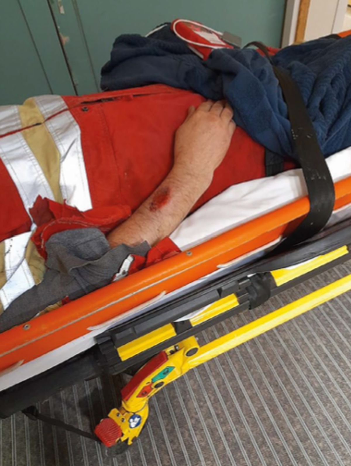 Crew member injured by rotating crank handle