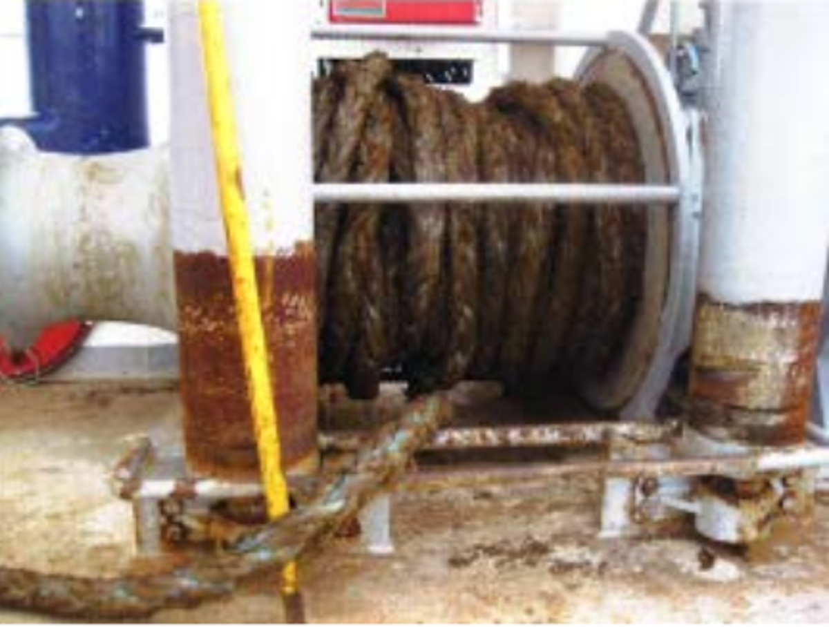 Boat Rope Injury Unsafe method of rope work resulted in severe hand injury
