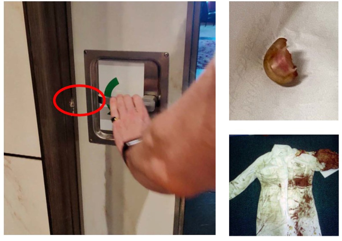 IMCA SF MAIB: “pinkie is no longer perkie” Images of door and finger