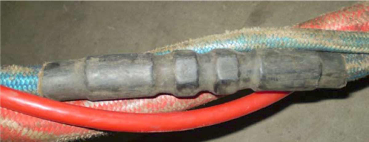 Umbilical