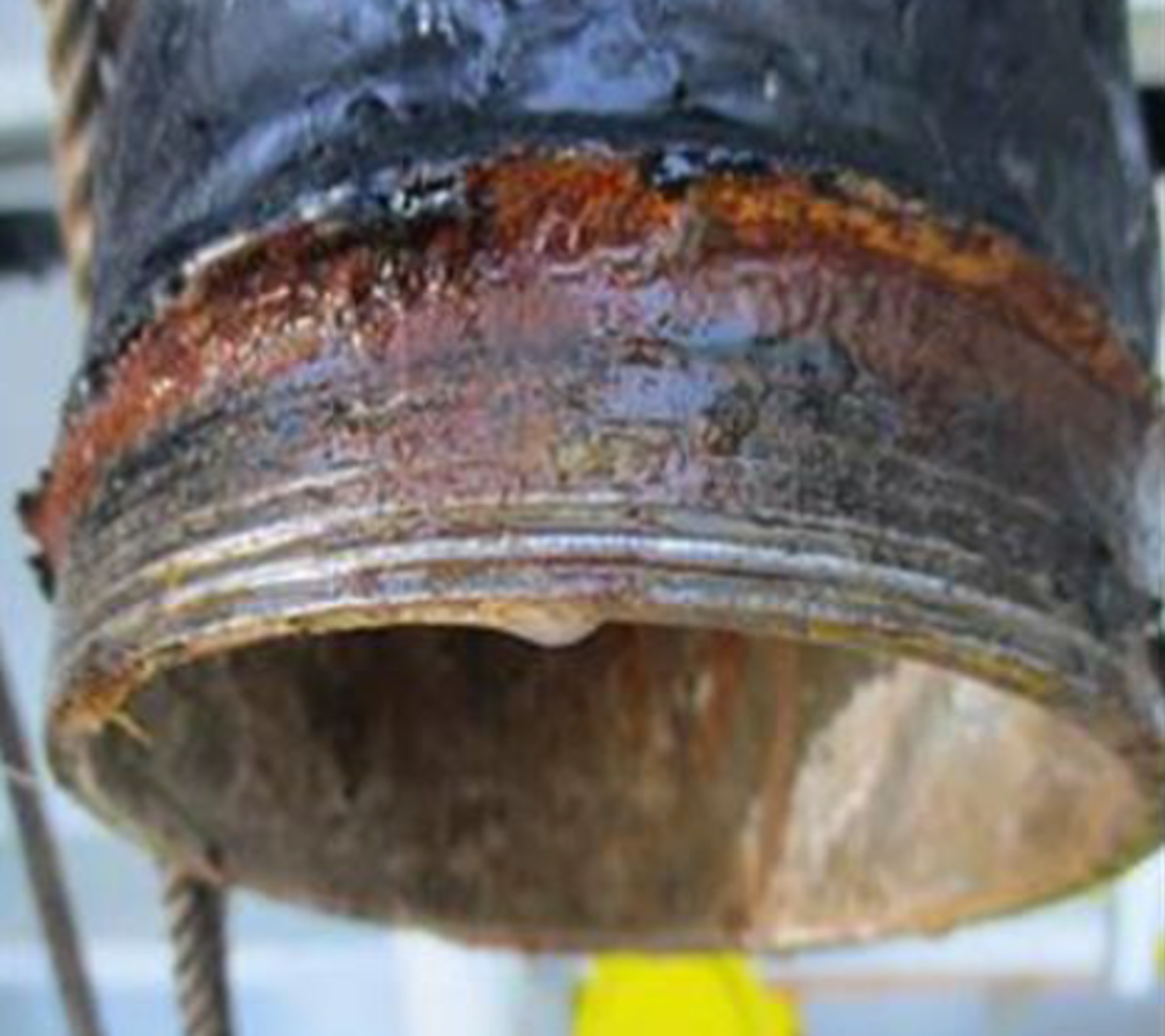 Serious injury caused by high-pressure washer