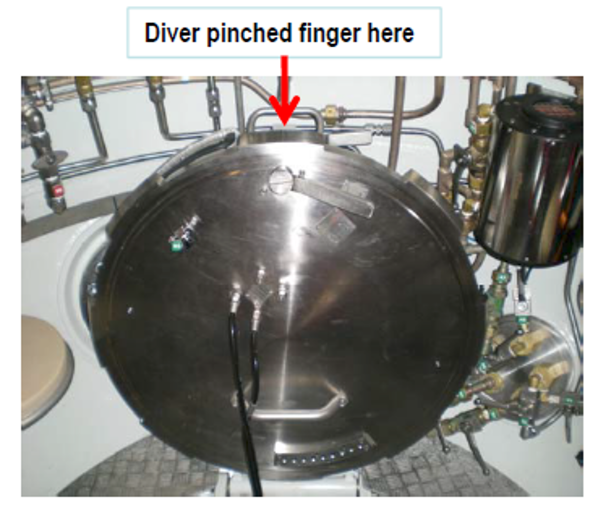 IMCA SF Finger injury: diver caught finger in bell door 1 Bell door
