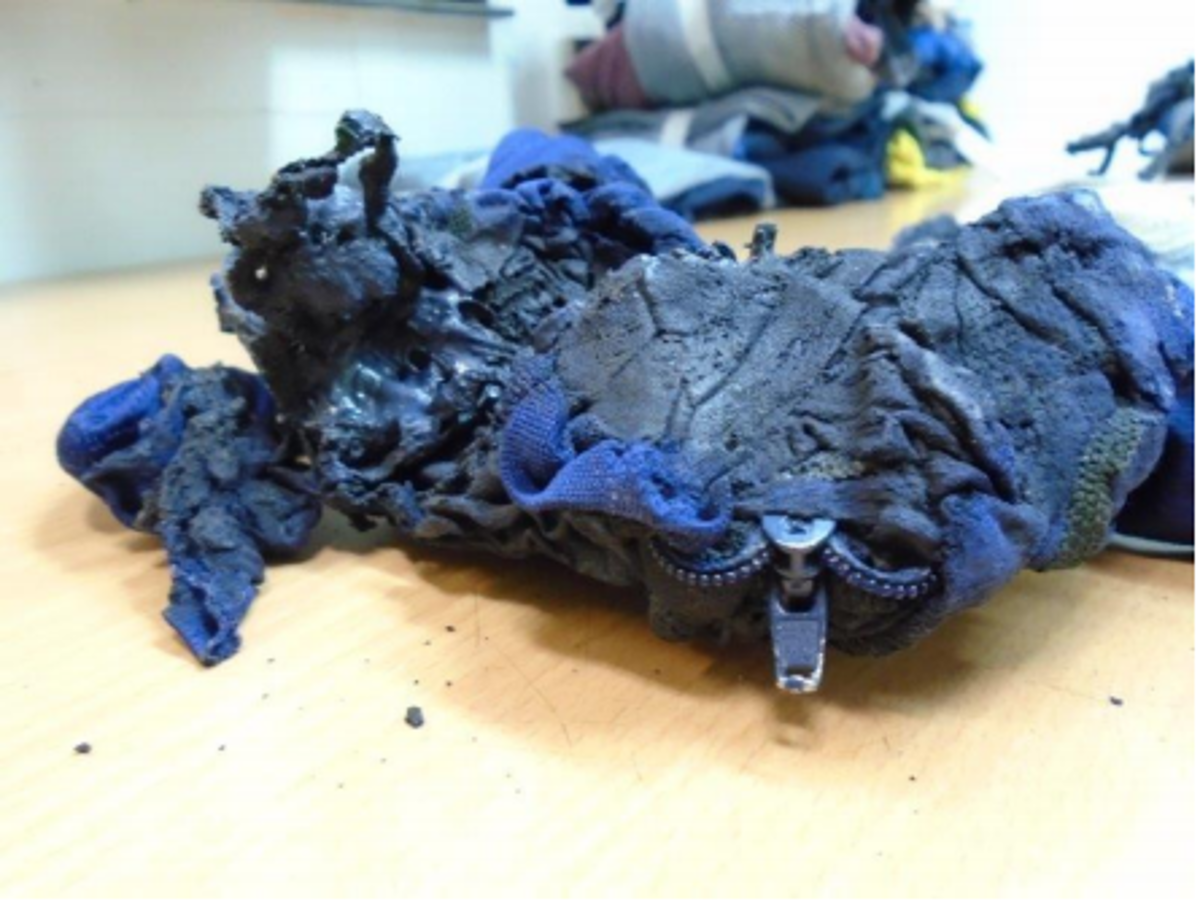 IMCA SF LTI: Burn to hand while working in laundry Burnt item