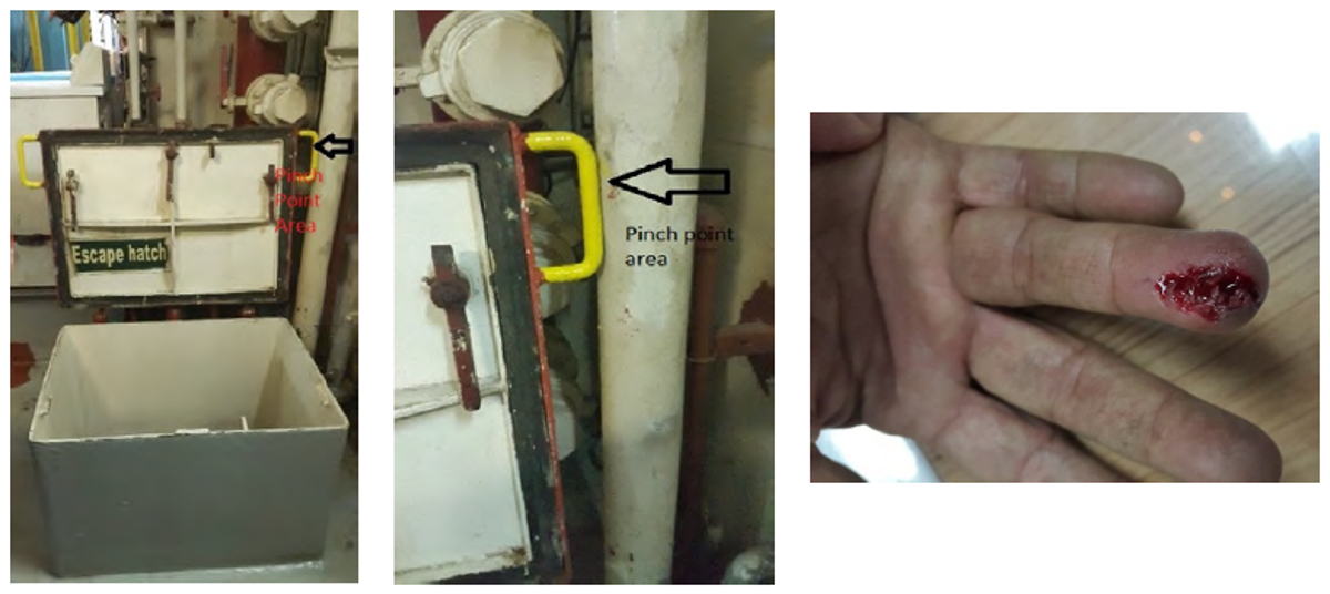 IMCA SF Finger injury: pinch point 1 Escape hatch, pinch area and injured finger