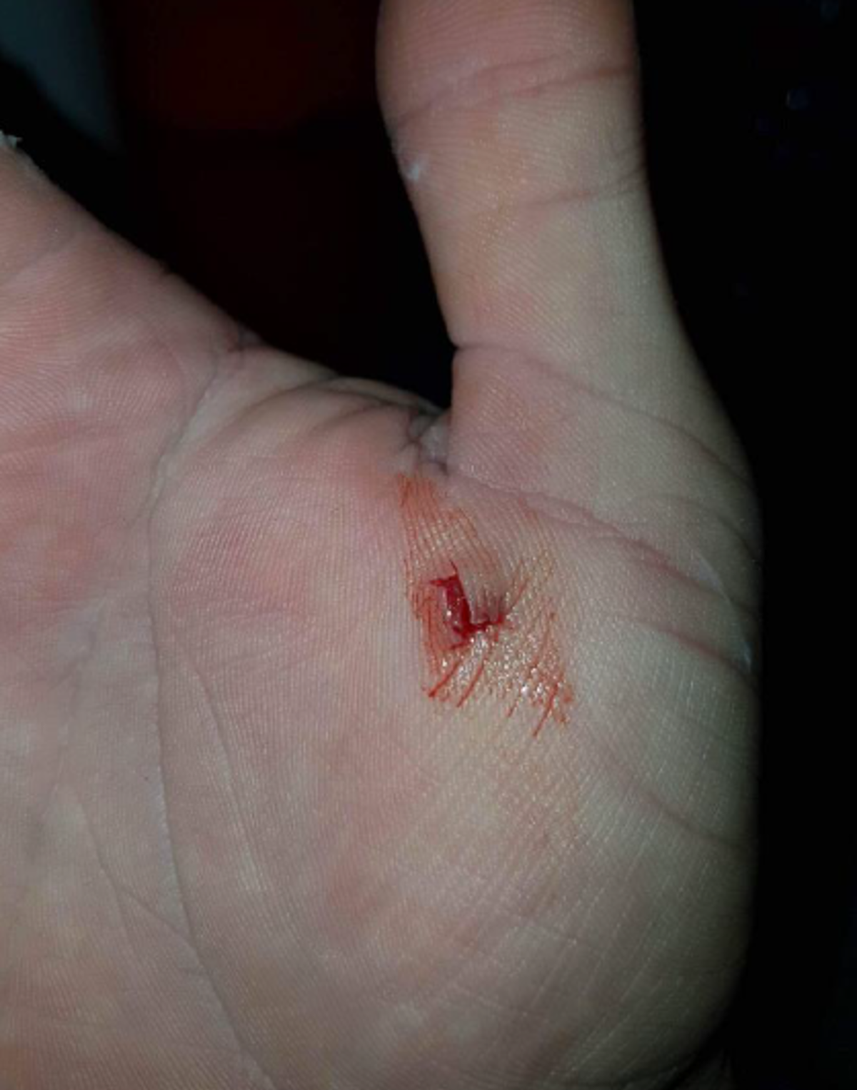 cut hand