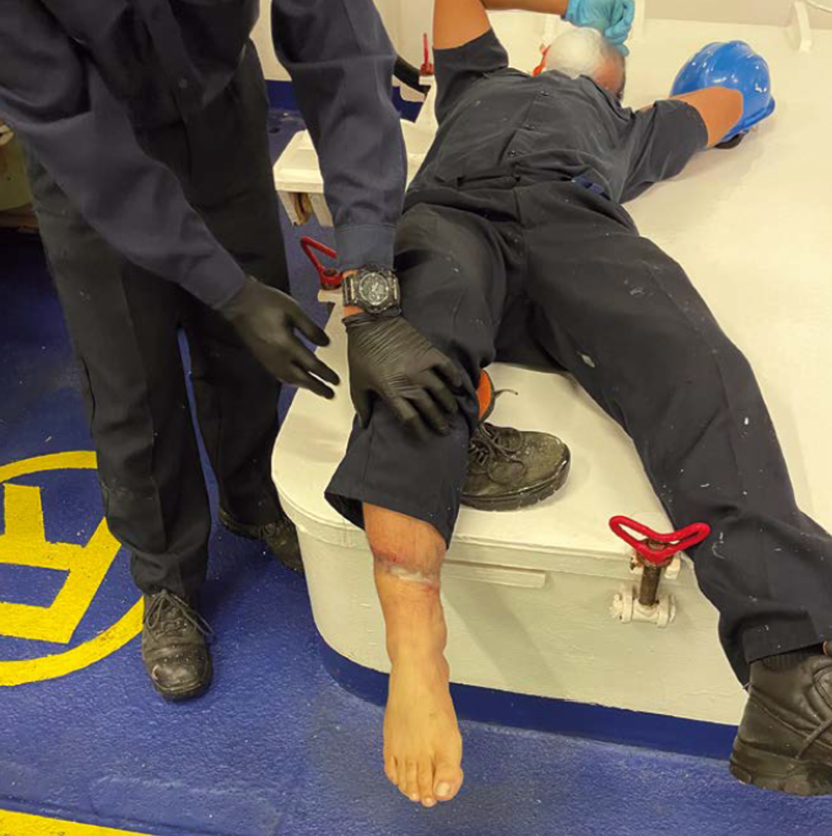 Leg injury while mooring