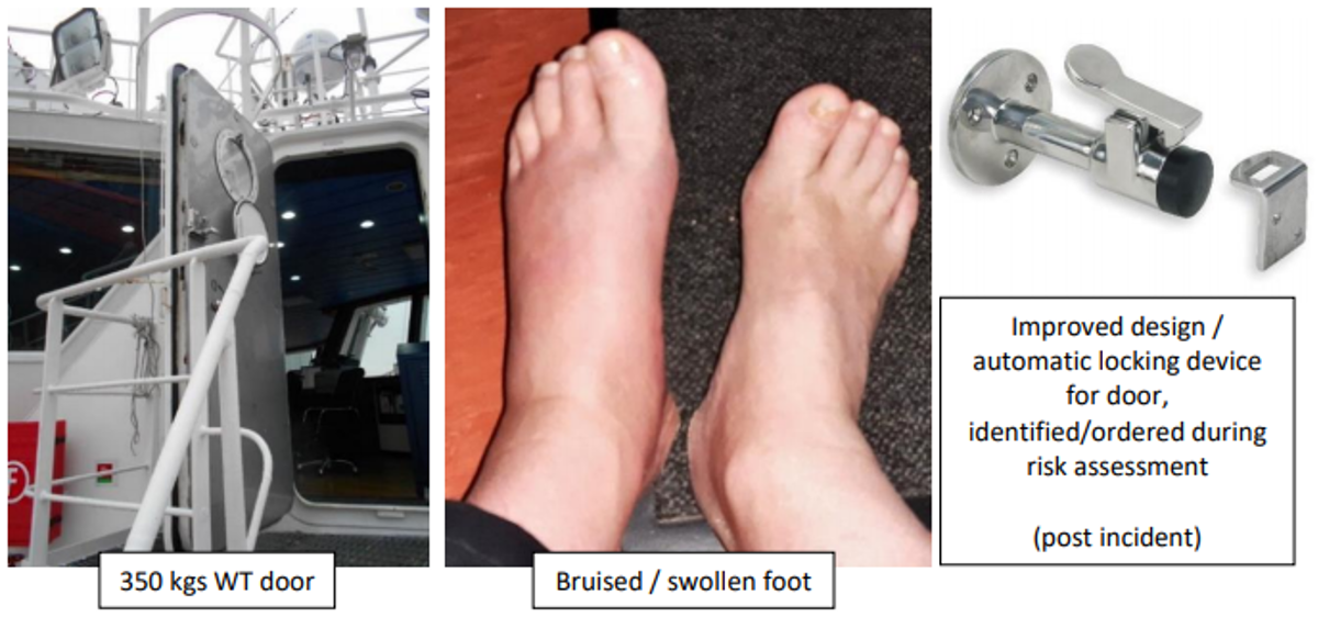 The injured person was not wearing safety boots or safety shoes at the time