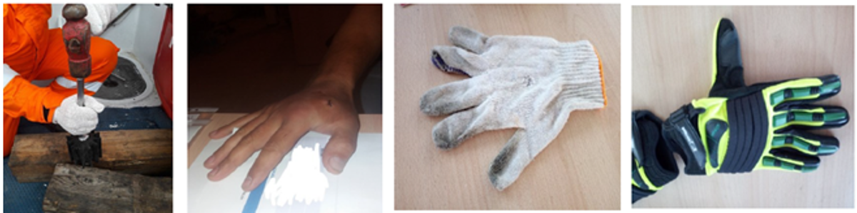 IMCA SF: Finger injury: What happens when you DON’T use the right tool for the right job Image12 While the crew member was hammering, a steel splinter of the punching rod (3-4 mm) chipped off and punctured his right hand